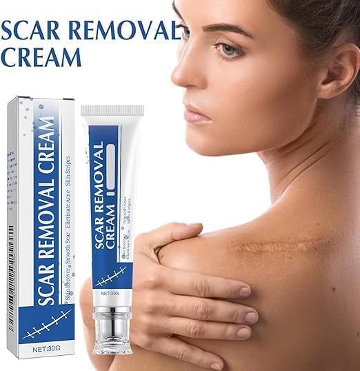 Scar removel Cream