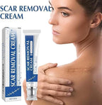 Scar removel Cream