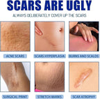 Scar removel Cream
