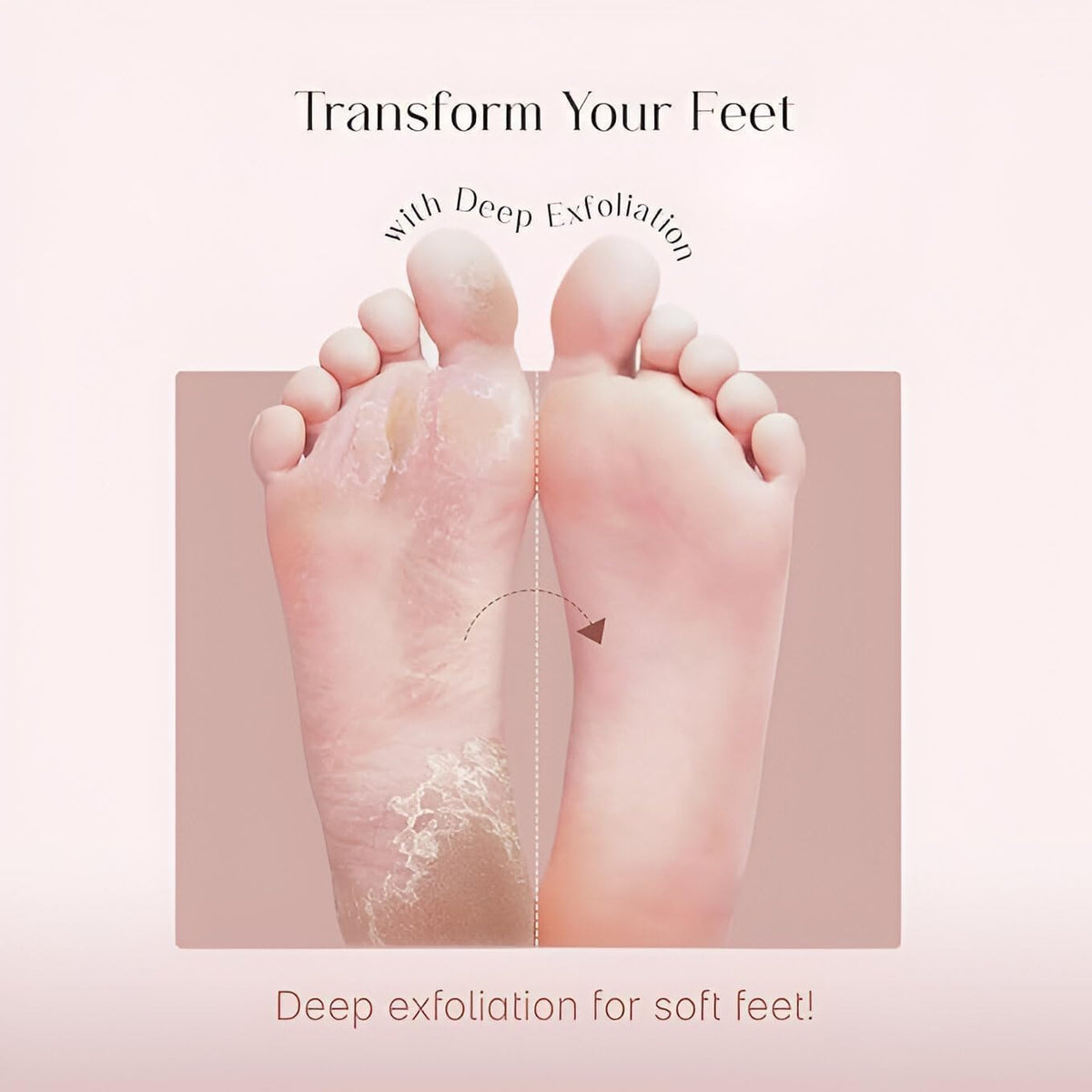 Peeling & Exfoliating Foot Mask