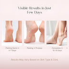 Peeling & Exfoliating Foot Mask