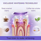 Purple Teeth Whitening Strips